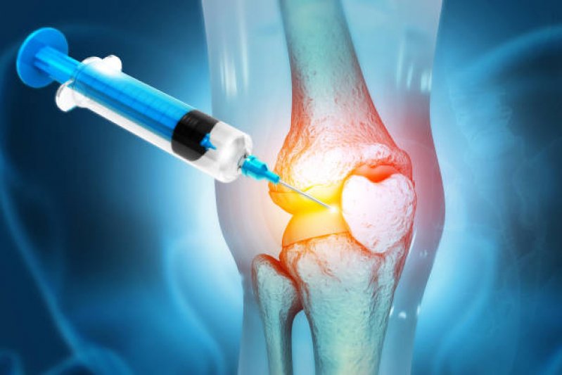 injecao-de-acido-hialuronico-no-quadril-dr-leandro-capuchinho